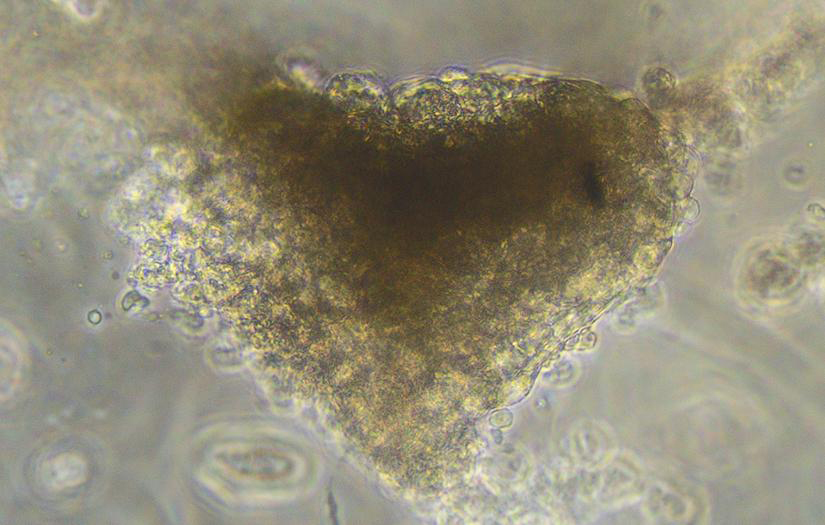 Image: Heart-shaped 3D bio-printed mini-heart using stem cells and hydrogels as bio-inks. Photo courtesy of Dr Carmine Gentile, Cardiovascular Regeneration Group, University of Technology Sydney.