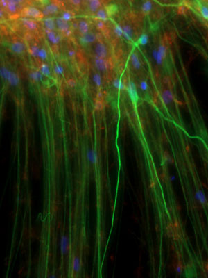Trish Adams, Synapse Residency 2019, Neuronal-processes-green-extending-from-human-stem-cell-derived-neurons, Dottori laboratory. Image courtesy Associate Professor Mirella Dottori, University of Wollongong.