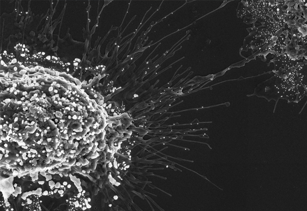 Andrea Rassell, Still from The Society of NanoBioSensing, Scanning Electron Microscopy image of prostate tumour cells with ZIF-8, a nano-engineered material that acts as a gene delivery system and cancer therapy for specifically targeted cells.