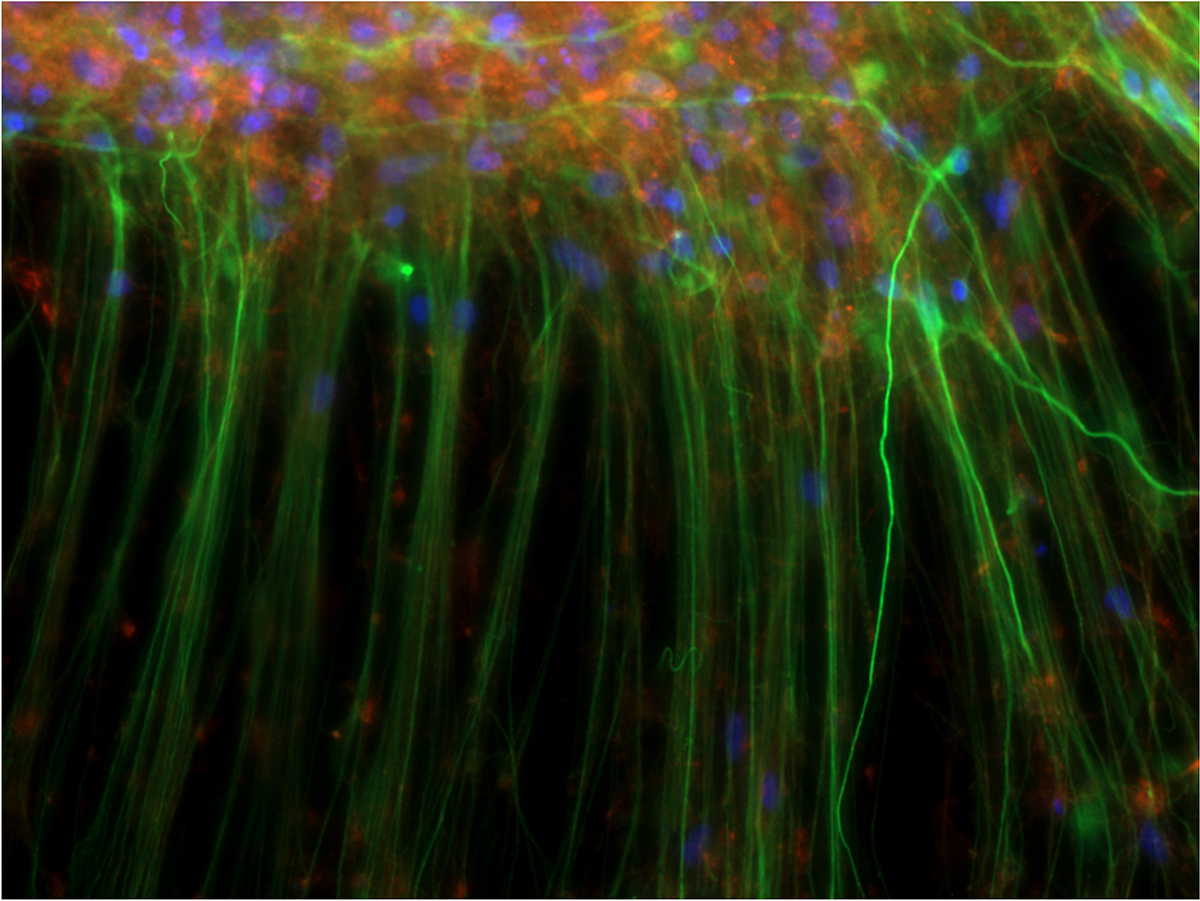 Trish Adams, Synapse Residency 2019, Neuronal-processes-green-extending-from-human-stem-cell-derived-neurons, Dottori laboratory. Image courtesy Associate Professor Mirella Dottori, University of Wollongong.