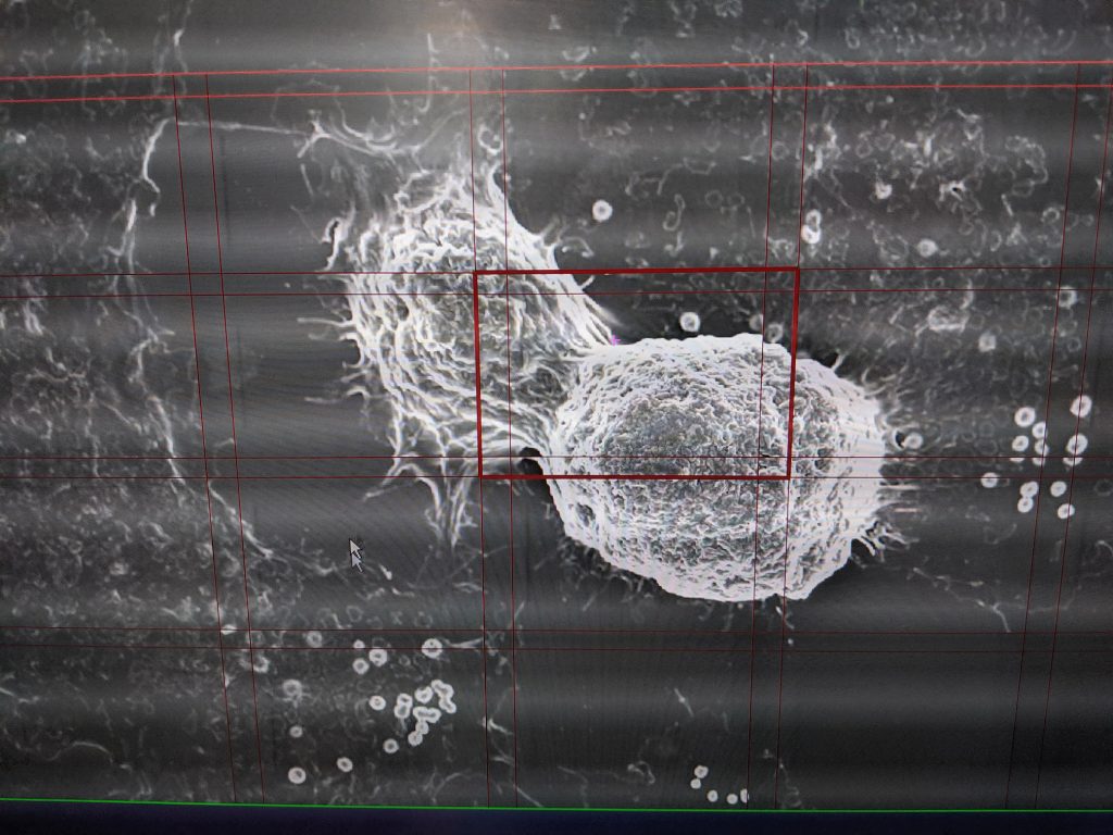 The gridded lines of the FEI MAPS software that enables data collection across large areas, producing images of up to a terabyte that have sufficiently high depth, width and height resolution that they can later be used for virtual applications.